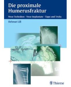 Die proximale Humerusfraktur: Neue Techniken, Neue Implantate - Tipps und Tricks [Gebundene Ausgabe] von Helmut Lill