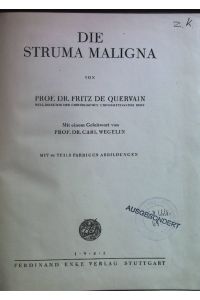 Die Struma Maligna  - Neue deutsche Chirurgie 64. Band