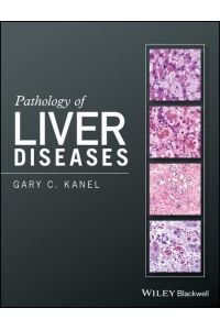 Pathology of Liver Diseases