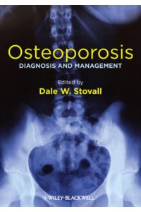 Osteoporosis - Diagnosis and Management