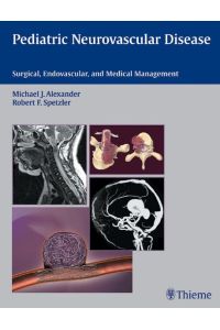 Pediatric Neurovascular Disease  - Surgical, Endovascular, and Medical Management