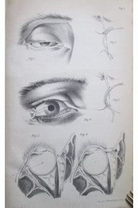 Weitere klinische Bemerkungen über Glaucom, glaucomatöse Krankheiten und über die Heilwirkung der Iridectomie. IN: v. Graefes Arch. Ophthal. , 1862, 4, 2. Abt, S. 127-61, HLn. d. Zt.