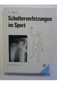 Schulterverletzungen im Sport.