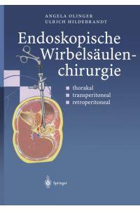 Endoskopische Wirbelsäulenchirurgie  - thorakal · transperitoneal · retroperitoneal