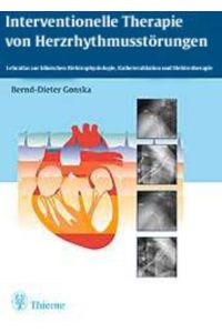 Interventionelle Therapie von Herzrhythmusstörungen  - Lehratlas der klinischen Elektrophysiologie, Katheterablation und Elektrotherapie