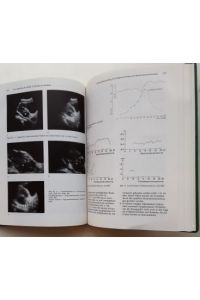Ultraschall in der Medizin. - 1. Jahrgang / 1980.