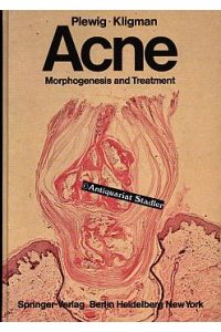 Acne. Morphogenesis and treatment.