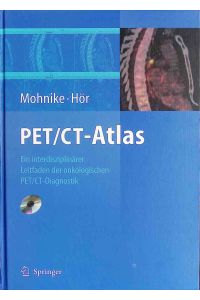 PET-, CT-Atlas : ein interdisziplinärer Leitfaden der onkologischen PET/CT-Diagnostik