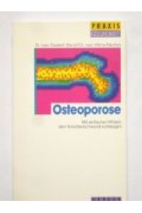 Osteoporose. Mit einfachen Mitteln dem Knochenschwund vorbeugen.   - Unter Mitw. von Nikolaus Böhler ..., Praxis Gesundheit.