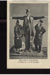 Riese Hans Helmuth, 18 Jahre, 2m 20cm groß.