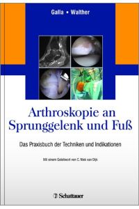 Arthroskopie an Sprunggelenk und Fuß  - Das Praxisbuch der Techniken und Indikationen
