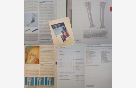 Kniegelenknahe Osteotomien. Indikation - Planung - Operationstechniken mit Plattenfixateurene