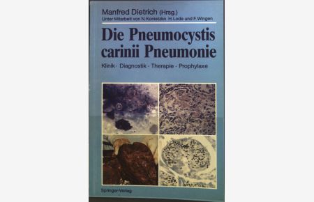 Die Pneumocystis carinii Pneumonie : Klinik, Diagnostik, Therapie, Prophylaxe.