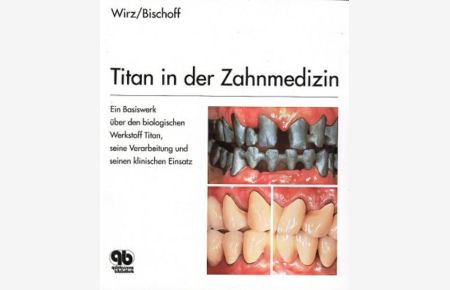 Titan in der Zahnmedizin  - Ein Basiswerk über den biologischen Werkstoff Titan, seine Verarbeitung und klin