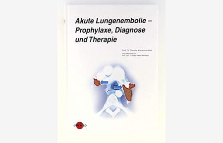 Akute Lungenembolie ? Prophylaxe, Diagnose und Therapie