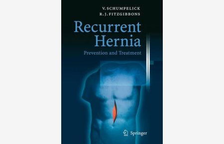 Recurrent Hernia  - Prevention and Treatment