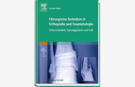 Chirurgische Techniken in Orthopädie und Traumatologie 8 Bände  - Unterschenkel, Sprunggelenk und Fuß