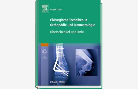 Chirurgische Techniken in Orthopädie und Traumatologie 8 Bände  - Oberschenkel und Knie