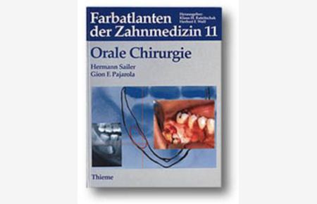 Farbatlanten der Zahnmedizin, Bd. 11, Orale Chirurgie