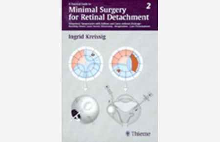 A Practical Guide to Minimal Surgery for Retinal Detachment, Vol. 2, Temporary Tamponades with Balloon andf Cases without Drainage, Buckling versus with Balloon and Gases Without Drainage: BD 2 von Ingrid Kreissig