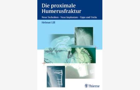 Die proximale Humerusfraktur: Neue Techniken, Neue Implantate - Tipps und Tricks [Gebundene Ausgabe] von Helmut Lill