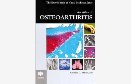 An Atlas of Osteoarthritis (Encyclopedia of Visual Medicine)