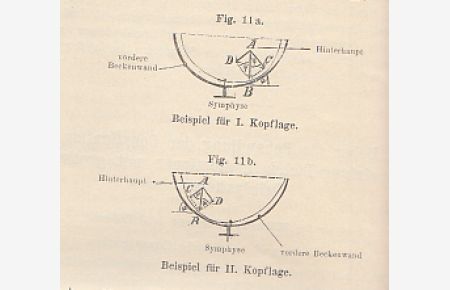 Der Geburtsmechanismus, spec. die Drehung des Hinterhauptes nach vorne. IN: Berl. klin. Wschr. , 30. /H. 3, S. 53-60 mit 11 fig. Darstellungen, 1893, Br.