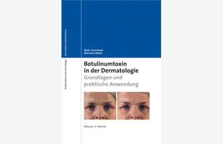 Botulinumtoxin in der Dermatologie : Grundlagen und praktische Anwendung.