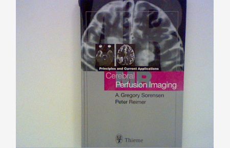 Cerebral MR Perfusion Imaging: Book + CD-ROM Set: Principles and Current Applications