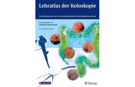 Lehratlas der Koloskopie: Das Referenzwerk zur Untersuchungstechnik und Befundinterpretation