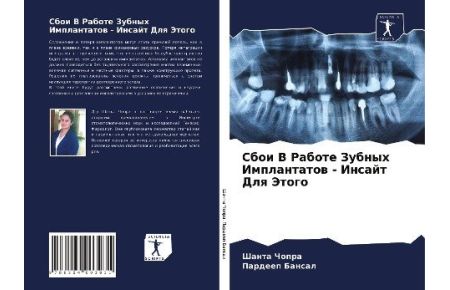 Sboi V Rabote Zubnyh Implantatow - Insajt Dlq Jetogo