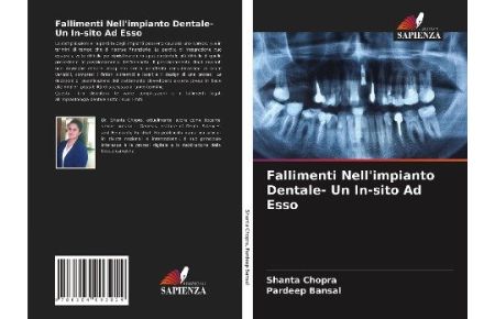 Fallimenti Nell'impianto Dentale- Un In-sito Ad Esso