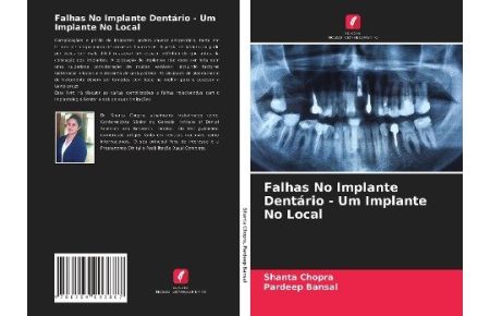 Falhas No Implante Dentário - Um Implante No Local